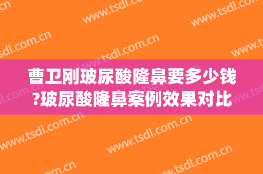 曹卫刚玻尿酸隆鼻要多少钱?玻尿酸隆鼻案例效果对比图_上海交通大学医学院附属第九人民医院