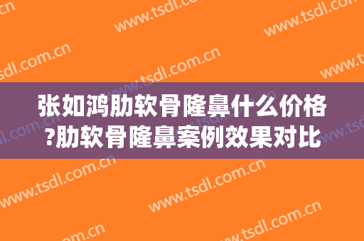 张如鸿肋软骨隆鼻什么价格?肋软骨隆鼻案例效果对比图_上海交通大学医学院附属第九人民医院
