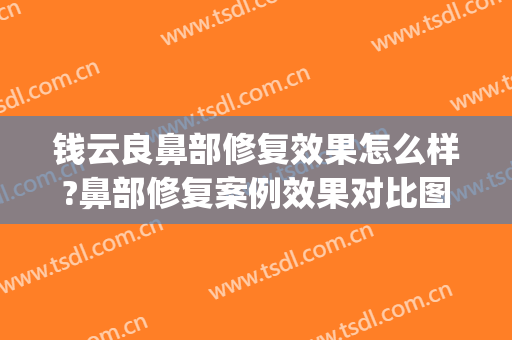 钱云良鼻部修复效果怎么样?鼻部修复案例效果对比图_上海交通大学医学院附属第九人民医院