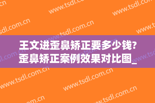 王文进歪鼻矫正要多少钱?歪鼻矫正案例效果对比图_上海交通大学医学院附属第九人民医院