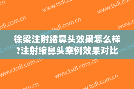 徐梁注射缩鼻头效果怎么样?注射缩鼻头案例效果对比图_上海交通大学医学院附属第九人民医院
