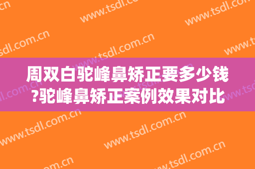 周双白驼峰鼻矫正要多少钱?驼峰鼻矫正案例效果对比图_上海交通大学医学院附属第九人民医院