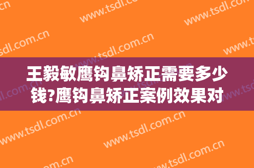 王毅敏鹰钩鼻矫正需要多少钱?鹰钩鼻矫正案例效果对比图_上海交通大学医学院附属第九人民医院