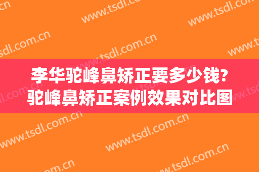 李华驼峰鼻矫正要多少钱?驼峰鼻矫正案例效果对比图_上海交通大学医学院附属第九人民医院