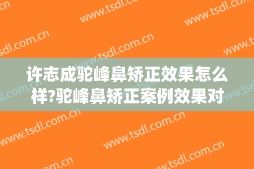 许志成驼峰鼻矫正效果怎么样?驼峰鼻矫正案例效果对比图_上海交通大学医学院附属第九人民医院