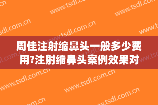 周佳注射缩鼻头一般多少费用?注射缩鼻头案例效果对比图_上海交通大学医学院附属第九人民医院