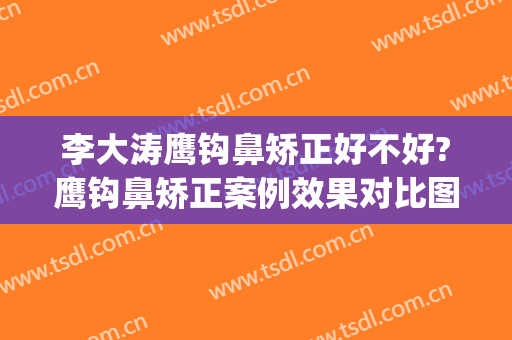 李大涛鹰钩鼻矫正好不好?鹰钩鼻矫正案例效果对比图_上海交通大学医学院附属第九人民医院