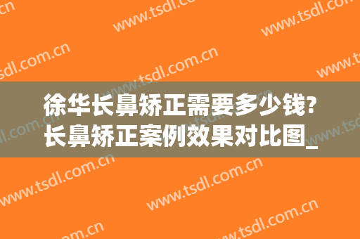 徐华长鼻矫正需要多少钱?长鼻矫正案例效果对比图_上海交通大学医学院附属第九人民医院