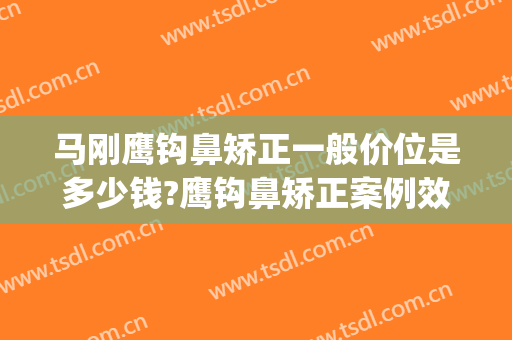 马刚鹰钩鼻矫正一般价位是多少钱?鹰钩鼻矫正案例效果对比图_上海交通大学医学院附属第九人民医院