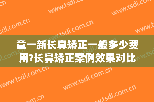 章一新长鼻矫正一般多少费用?长鼻矫正案例效果对比图_上海交通大学医学院附属第九人民医院