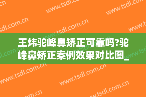 王炜驼峰鼻矫正可靠吗?驼峰鼻矫正案例效果对比图_上海交通大学医学院附属第九人民医院