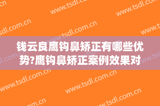 钱云良鹰钩鼻矫正有哪些优势?鹰钩鼻矫正案例效果对比图_上海交通大学医学院附属第九人民医院