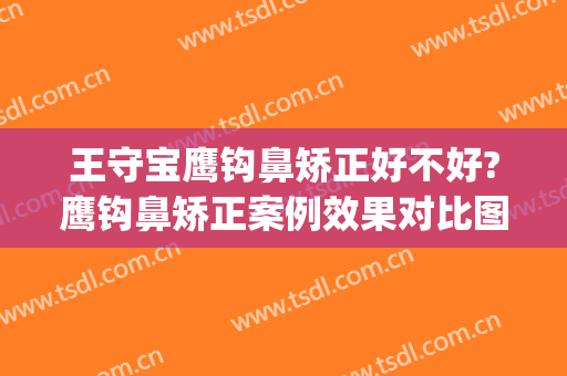 王守宝鹰钩鼻矫正好不好?鹰钩鼻矫正案例效果对比图_上海交通大学医学院附属第九人民医院
