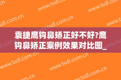 袁捷鹰钩鼻矫正好不好?鹰钩鼻矫正案例效果对比图_上海交通大学医学院附属第九人民医院