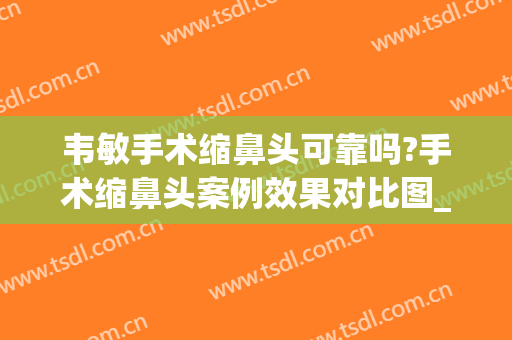 韦敏手术缩鼻头可靠吗?手术缩鼻头案例效果对比图_上海交通大学医学院附属第九人民医院