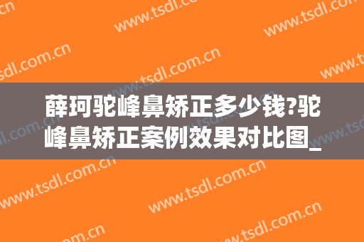 薛珂驼峰鼻矫正多少钱?驼峰鼻矫正案例效果对比图_上海交通大学医学院附属第九人民医院