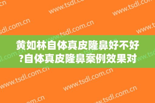 黄如林自体真皮隆鼻好不好?自体真皮隆鼻案例效果对比图_上海交通大学医学院附属第九人民医院