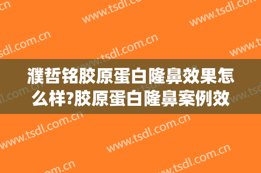濮哲铭胶原蛋白隆鼻效果怎么样?胶原蛋白隆鼻案例效果对比图_上海交通大学医学院附属第九人民医院