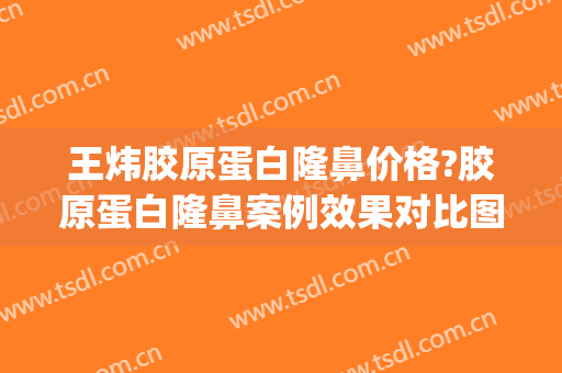 王炜胶原蛋白隆鼻价格?胶原蛋白隆鼻案例效果对比图_上海交通大学医学院附属第九人民医院