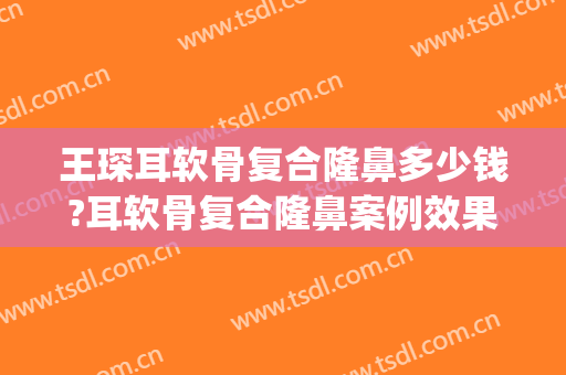 王琛耳软骨复合隆鼻多少钱?耳软骨复合隆鼻案例效果对比图_上海交通大学医学院附属第九人民医院