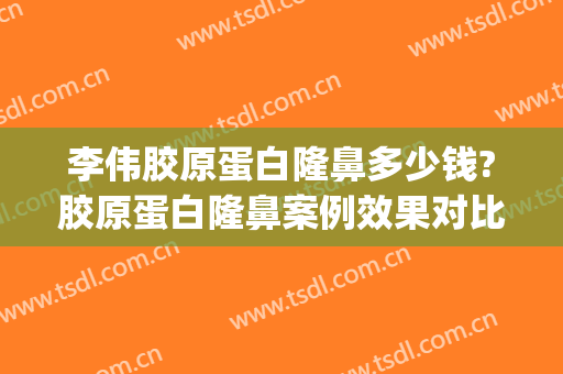 李伟胶原蛋白隆鼻多少钱?胶原蛋白隆鼻案例效果对比图_上海交通大学医学院附属第九人民医院