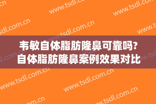 韦敏自体脂肪隆鼻可靠吗?自体脂肪隆鼻案例效果对比图_上海交通大学医学院附属第九人民医院