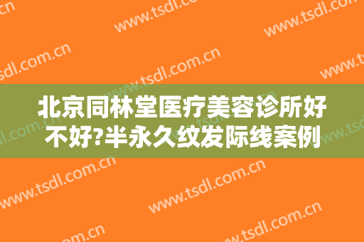 北京同林堂医疗美容诊所好不好?半永久纹发际线案例效果对比图