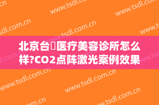 北京台娢医疗美容诊所怎么样?CO2点阵激光案例效果对比图(北京台娢医疗美容医院)