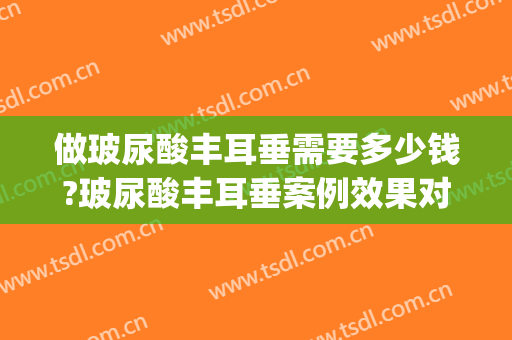 做玻尿酸丰耳垂需要多少钱?玻尿酸丰耳垂案例效果对比图(玻尿酸丰耳垂注意事项)