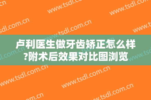 卢利医生做牙齿矫正怎么样?附术后效果对比图浏览
