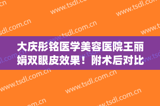 大庆彤铭医学美容医院王丽娟双眼皮效果！附术后对比图浏览欣赏(大庆彤铭医疗美容医院)