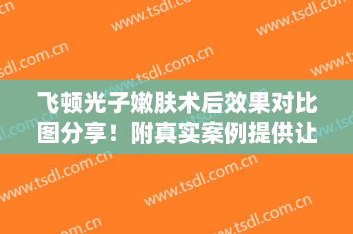 飞顿光子嫩肤术后效果对比图分享！附真实案例提供让大家欣赏(飞顿2号激光祛斑实例)