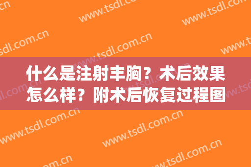什么是注射丰胸？术后效果怎么样？附术后恢复过程图浏览(什么是注射丰胸手术)