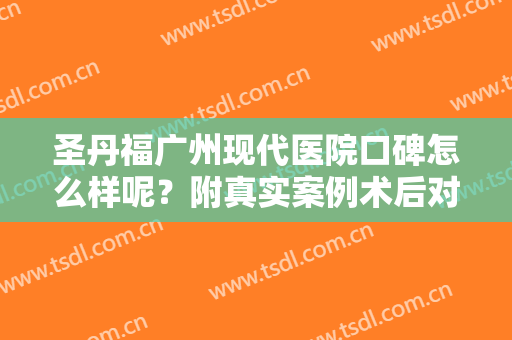 圣丹福广州现代医院口碑怎么样呢？附真实案例术后对比图浏览