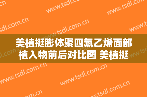美植挺膨体聚四氟乙烯面部植入物前后对比图 美植挺膨体聚四氟乙烯面部植入物效果图 美植挺膨体聚四氟乙烯面部植
