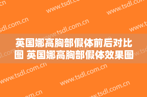 英国娜高胸部假体前后对比图 英国娜高胸部假体效果图 英国娜高胸部假体前后对比照片