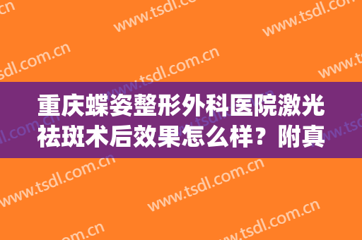重庆蝶姿整形外科医院激光祛斑术后效果怎么样？附真实案例参考(重庆激光治雀斑)