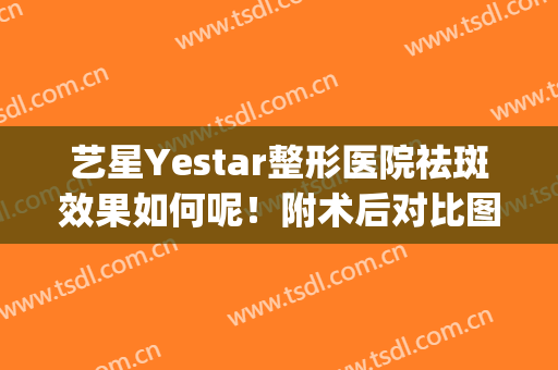 艺星Yestar整形医院祛斑效果如何呢！附术后对比图让大家浏览(艺星祛斑效果怎么样)