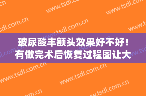玻尿酸丰额头效果好不好！有做完术后恢复过程图让大家欣赏(玻尿酸丰额头几天平整)