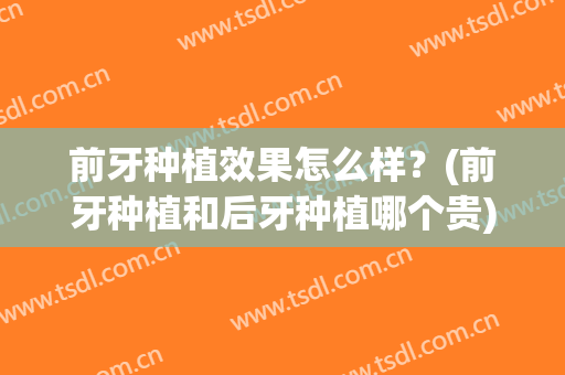前牙种植效果怎么样？(前牙种植和后牙种植哪个贵)