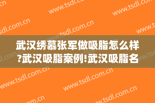 武汉绣慕张军做吸脂怎么样?武汉吸脂案例!武汉吸脂名医推荐(武汉面部吸脂有名的医生)