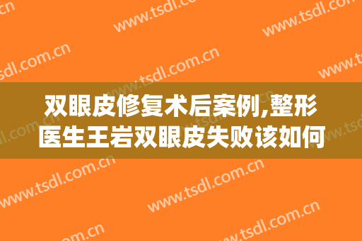 双眼皮修复术后案例,整形医生王岩双眼皮失败该如何?(双眼皮整容手术失败)