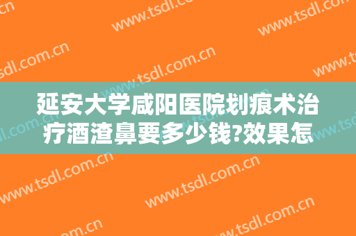 延安大学咸阳医院划痕术治疗酒渣鼻要多少钱?效果怎么样?