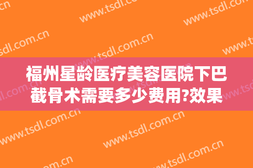 福州星龄医疗美容医院下巴截骨术需要多少费用?效果怎么样?(福州星龄整形医院电话)
