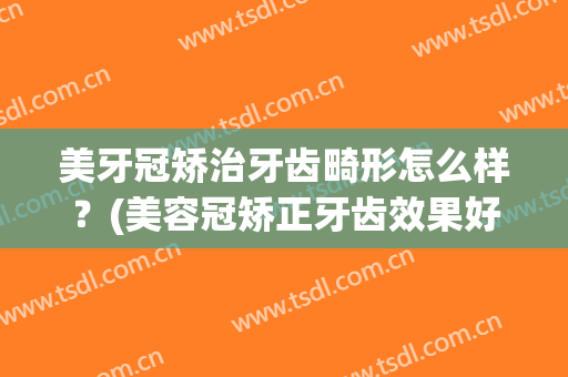美牙冠矫治牙齿畸形怎么样？(美容冠矫正牙齿效果好不好)