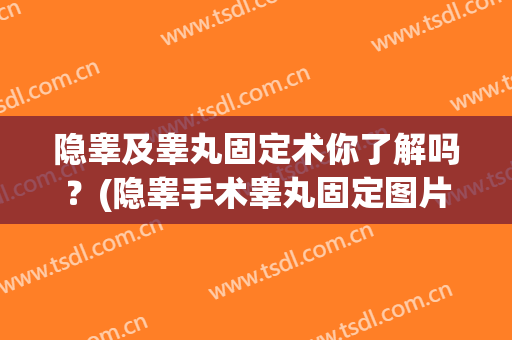 隐睾及睾丸固定术你了解吗？(隐睾手术睾丸固定图片)