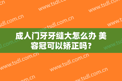 成人门牙牙缝大怎么办 美容冠可以矫正吗？