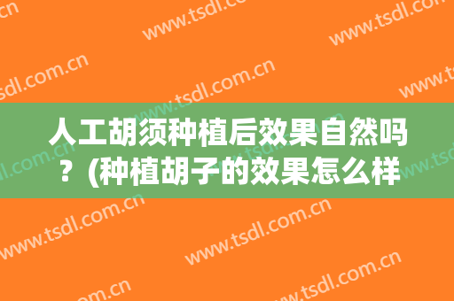 人工胡须种植后效果自然吗？(种植胡子的效果怎么样)