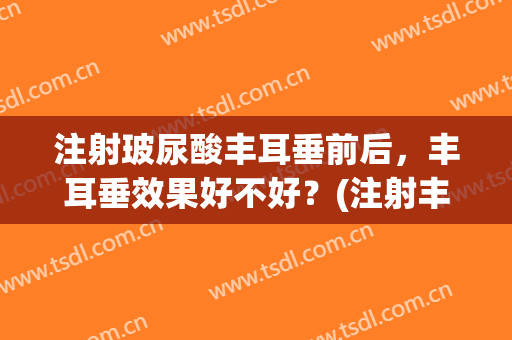 注射玻尿酸丰耳垂前后，丰耳垂效果好不好？(注射丰耳垂整形前后对比)