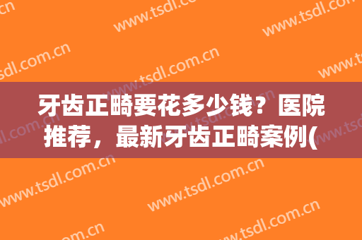 牙齿正畸要花多少钱？医院推荐，最新牙齿正畸案例(一般正畸牙齿需要多少钱)